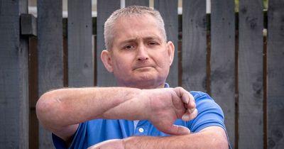 Scots dad receives 'world's first' double hand transplant and thanks doctors for new lease of life