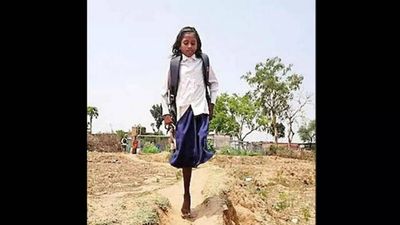 Bihar: Helps pour in as 10-year-old girl hops 1km to school on one leg