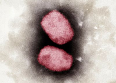 Monkeypox spreading through sex, but not an STI