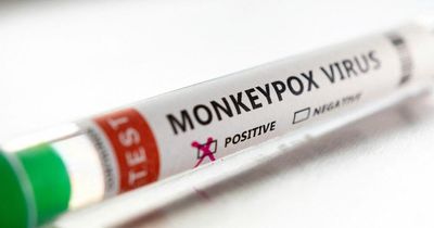 Monkeypox cases continue to rise with 90 now across the UK