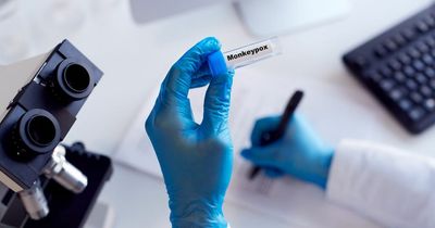 Monkeypox patients may face three weeks isolation period