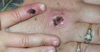 Monkeypox experts say family pets could be put into quarantine