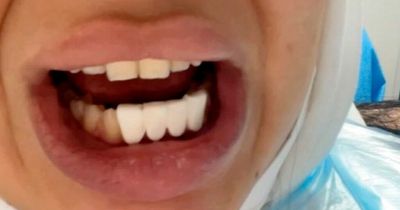 Woman looked like 'a horse' with 'piano key' teeth after botched dental op