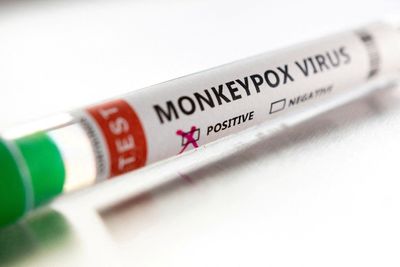 First case of monkeypox confirmed in Ireland