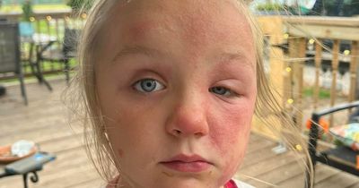 Mum shares urgent warning after 6-year-old 'poisoned' by 'deadly' plant growing in gardens everywhere