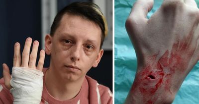 Hamilton man traumatised after dog attack in park left blood 'spraying all over' him