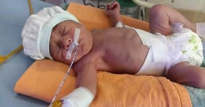 Mum's desperate plea to get baby girl home after she is born two months early in Turkey