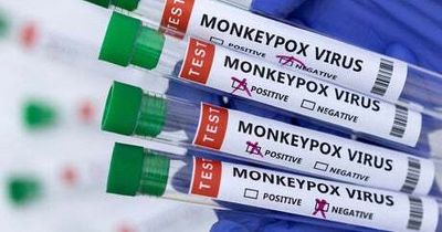 Monkeypox: 71 more cases detected in England as UK total jumps to 179