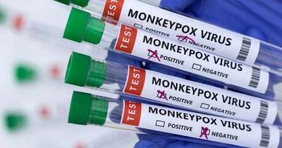 Monkeypox expert ‘does not expect another pandemic’