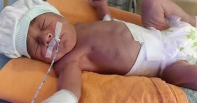 Brit couple facing £27k bill after baby girl is born two months early in Turkey