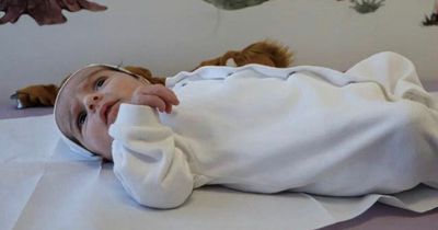 Baby at risk of dying because gullet didn't reach stomach saved by doctors