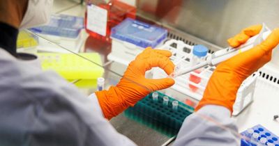Monkeypox cases hit 190 as infection spreads across UK - public asked to stay alert