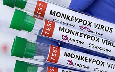 Health Ministry issues norms to tackle monkeypox