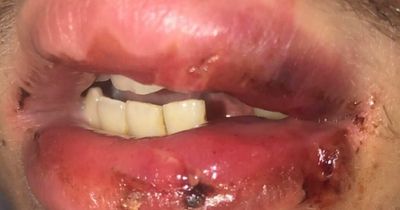 Family 'mortified' as Leeds man loses tooth in 'unprovoked attack' in McDonald's