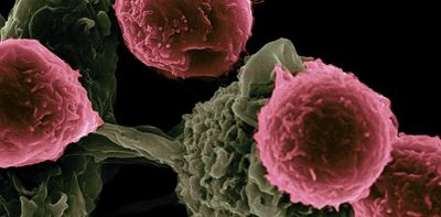 'Masked' cancer drug stealthily trains immune system to kill tumors while sparing healthy tissues, reducing treatment side effects