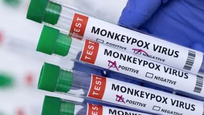 Monkeypox Virus: Over 550 confirmed cases detected in 30 countries