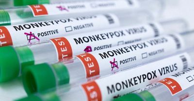 Monkeypox cases in each region as London records 70% of England's infections