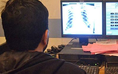 Community involvement aiding battle against TB in Assam