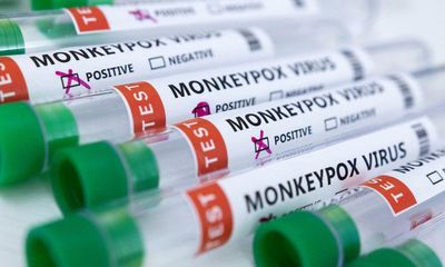 Fifth case of monkeypox discovered in New York City