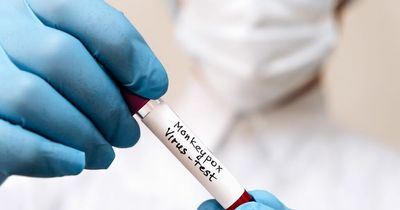 Europe at epicentre of monkeypox outbreak as cases triple globally