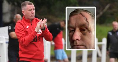 Grave concerns over faulty CCTV following brutal attack on East Kilbride Thistle boss