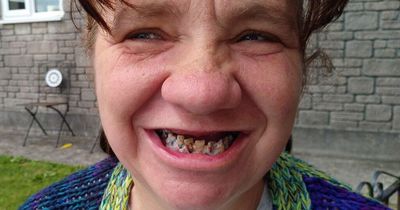 Woman who avoided dentist for a decade can't eat as her teeth turned black and CRUMBLED