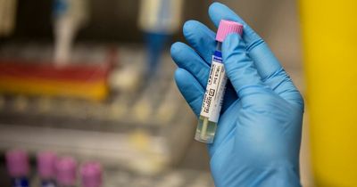 Monkeypox cases triple around the world as Europe at epicentre of outbreak