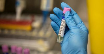 Two more Monkeypox cases reported in Scotland as UK total rises over 300