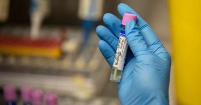 Scotland records two further Monkeypox cases as UK total surpasses 300 mark