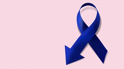 "Unheard of": Trial of rectal cancer drug leads to remission in every patient