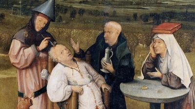 'Pain was a blessing': The surprising history of surgery