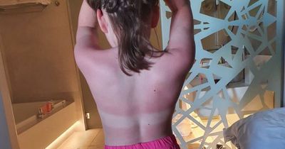 Mum claims Asda sun cream left kids burned and stained her hands pink on holiday