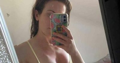'I thought I had a massive pimple but it turned out to be a deadly tumour'