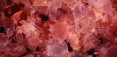 What is ectopic pregnancy? A reproductive health expert explains