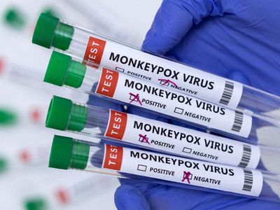 Doctors in UK must now report suspected monkeypox cases to health authorities