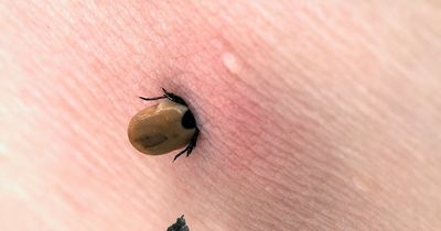 The 'safest way' to remove a tick from a human according to experts