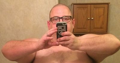 Man loses half body weight after 'man boobs' grow to same size as wife's C cups