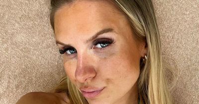 Love Island's Chloe Burrows stuns fans as she embraces her 'natural' beauty