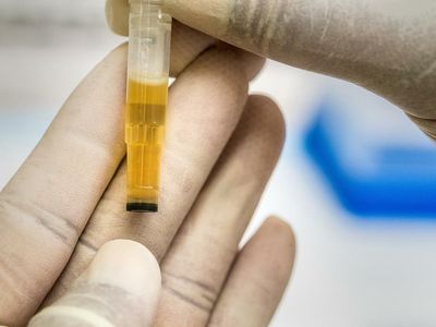 Fake Urine To Pass A Drug Test? It's A Thing And Michigan Wants To Stop It, Here's What's Happening