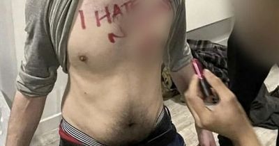 Swastika and vile racist slur scrawled in red lipstick on student's chest