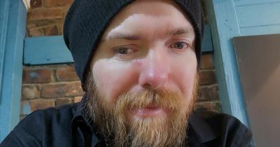 Man claims he's getting rejected from jobs because of the way he looks