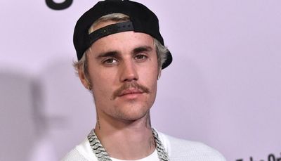 Justin Bieber says half his face is paralyzed due to Ramsay Hunt syndrome