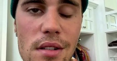 Justin Bieber tearfully asks fans 'pray for me' as he battles facial paralysis