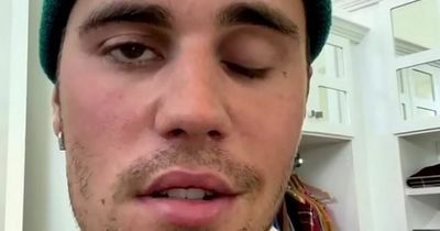 What is Ramsay Hunt syndrome as Justin Bieber reveals paralysed face in video