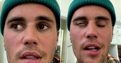 Justin Bieber's 'severe' facial paralysis could cause 'long-term' damage, expert says