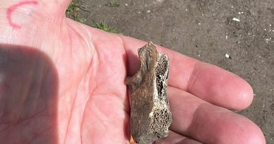 'Child's bones' uncovered in Bristol park