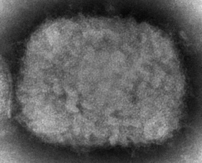 UK reports 104 more cases of monkeypox, mostly in men