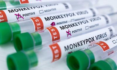 England records 104 new monkeypox cases, bringing total to 452