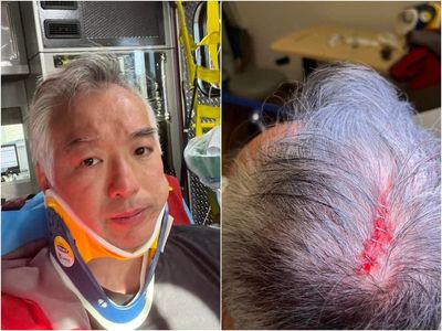 Cement block dropped on head of San Francisco councilman in apparent hate crime