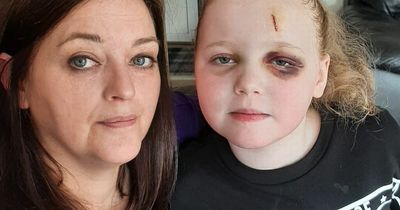 Mum of little Scots girl who suffers 300 seizures a day says daughter 'robbed of childhood'